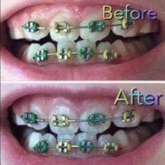 Toothpaste - Picture 4 of 7